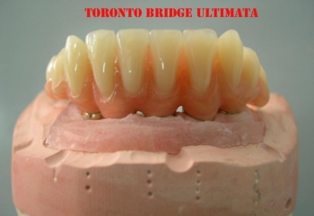 Toronto bridge inferiore con passivazione ad incollaggio