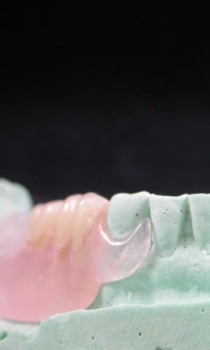 Sabilex flexible denture
